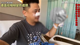 鼻塞20年難呼吸　他割息肉曝心得