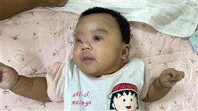 賴永清醫師表示，女嬰父親在嬰幼期有長期腹瀉病史，女嬰母親有過敏性鼻炎及異位性皮膚炎，寶寶有高達8－9成機率會遺傳過敏體質（圖／烏日林新醫院提供）