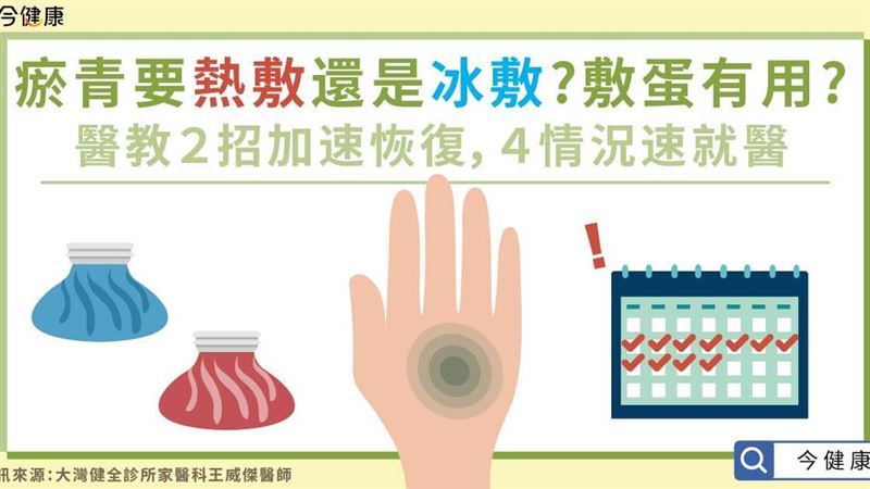 瘀青如何處理？異常瘀青身體有狀況