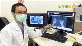 賴建志醫師呼籲，類風濕性關節炎患者應積極施打新冠疫苗，減少重症及死亡風險發生。