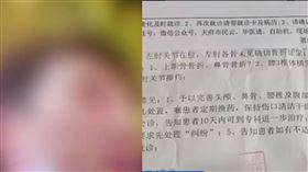 中國劉姓直播主遭毆。(圖／澎派新聞微博)