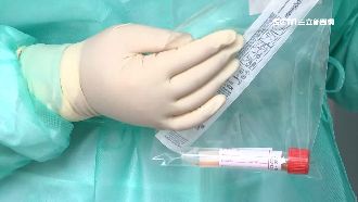 門診手術須自費PCR　民怨不合理