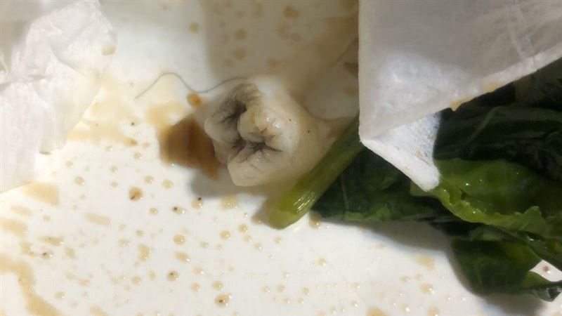 噁！台中女點外送　湯底撈出「蛀牙」