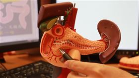 九十高齡老翁因暴瘦、膚色變黃，到台中慈濟醫院門診，輾轉由肝膽腸胃、血液腫瘤科確認罹患胰臟癌（圖／台中慈院提供）