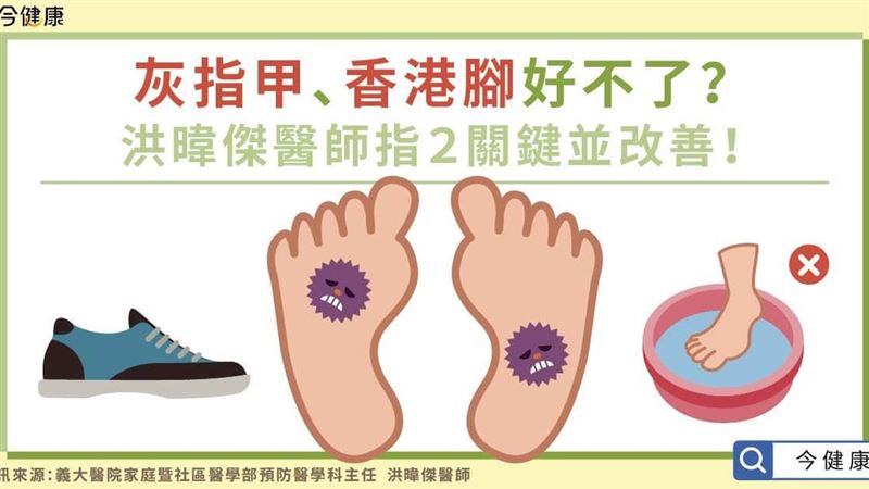 灰指甲香港腳勿輕忽　恐釀各種併發症