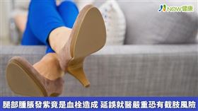 名家專用／NOW健康／長時間缺乏活動，血管受傷或血液凝血功能異常引起，造成靜脈血管內出現微小血栓使血液回流受阻而引起腿部腫脹甚至發麻等症狀，並隨著年紀越大產生的機會越大。(勿用)