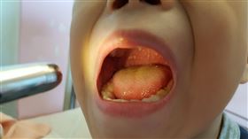 台中慈濟醫院小兒科醫師李宇正提醒，最近因腸病毒就醫、住院的小病人呈現增加趨勢，提醒家長叮囑孩子戴口罩之外，也要正確洗手，萬一感染腸病毒，也要落實生病不上課，避免交叉感染（圖／台中慈院提供）