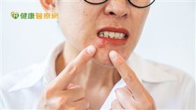 中山醫院副院長暨生殖中心負責人李世明醫生表示：疫情期間宅親密也要加強自我防護，避免交錯感染風險。