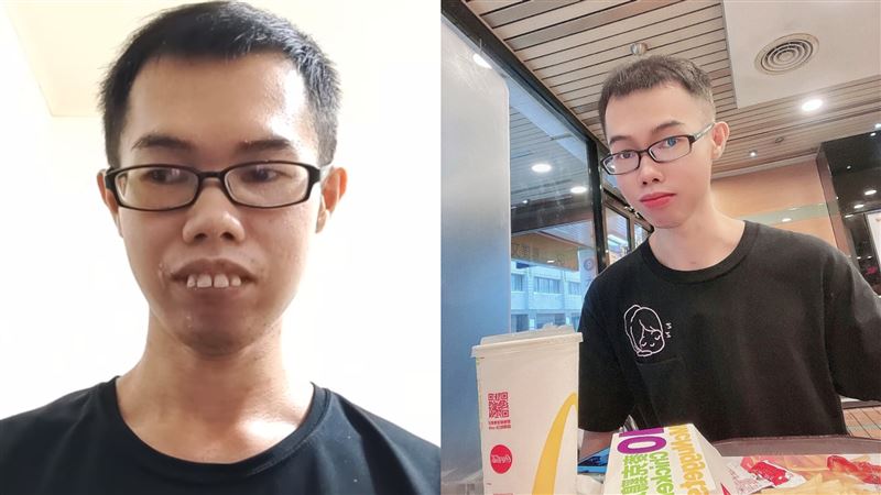 鄧佳華宣布整牙　粉絲崩潰：千萬不要