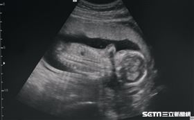 專題【勇敢的愛】