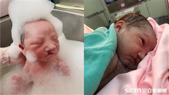 有胎動確診唇腭裂　新手爸媽淚曝決定