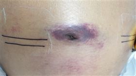 屏東基督教醫院提供