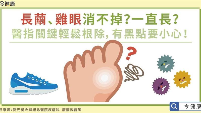 長繭、雞眼消不掉？醫指２關鍵！