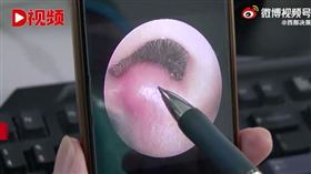 挖鼻孔,男童,細菌（圖／翻攝自《頭條新聞》微博）