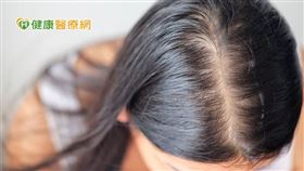 無論是先天遺傳性因素、後天外在身體壓力導致的落髮問題，例如手術、嚴重外傷、嚴重的急性或慢性病、過度身體疲勞等都會造成大量頭髮進入休止期落髮。