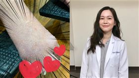  美女醫驚見「阿嬤的腳」滲出分泌物（圖／翻攝自吳欣岱臉書