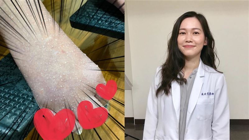 阿嬤腳腫到滲分泌物！美女醫一看嚇傻
