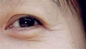 ▲女性魚尾紋。（示意圖／翻攝自Pixabay）