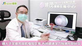 名家專用／NOW健康／婦茂婦幼診所院長陳杰盛指出子宮內部瘜肉位置。(勿用)