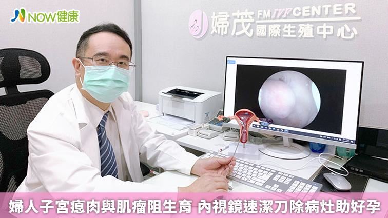 內視鏡速潔刀除病灶助好孕