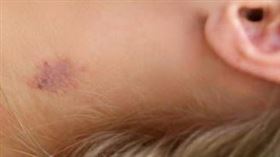 新北,直銷,性行為,常客,吻痕,（示意圖／pixabay）