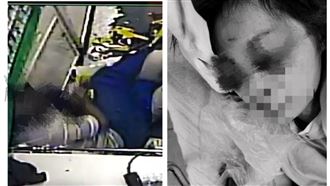 女店員提醒戴口罩　男怒戳她眼3分鐘