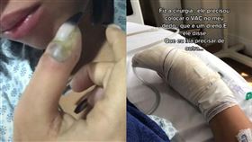 ▲蘇莎因蜂窩性組織炎截肢。（圖／翻攝自抖音）