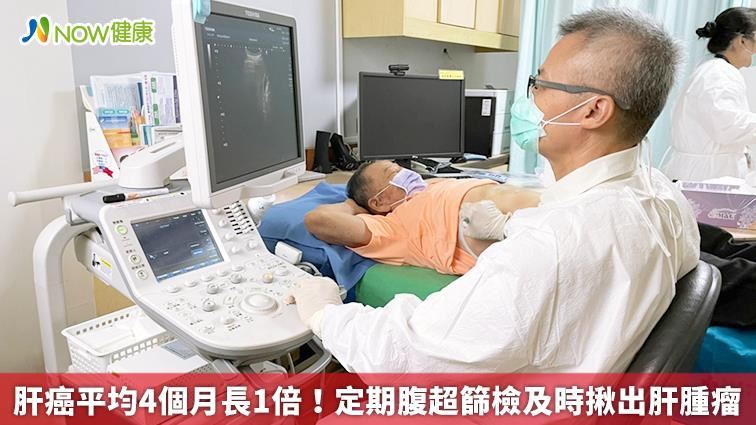 定期腹超篩檢及時揪出肝腫瘤