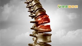 劉峰誠醫師提醒，中軸性脊椎關節炎除了關節症狀外，發炎因子也經常侵蝕體內其他器官。因此，若有下背部疼痛超過三個月、晨間僵硬，合併眼睛反覆紅腫、視力模糊等高危險訊號，建議盡快至風濕免疫科進一步檢查。