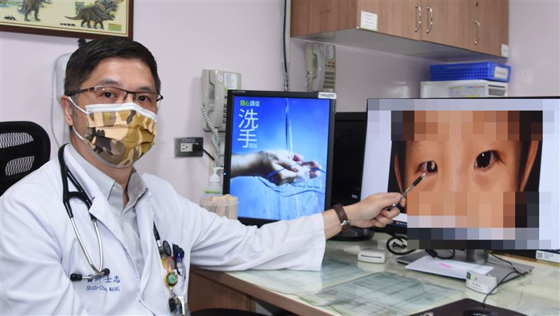 瞳孔像貓！視網膜母細胞瘤奪幼童眼球