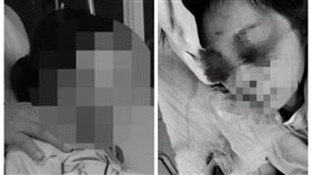 屏東,高樹,超商,挖眼,女店員,捐款