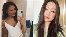 23歲網美燙傷（圖／翻攝自IG／Charlene Chew）
