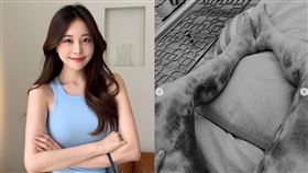 Aori身上爬滿瘀青，丈夫相當心疼。（圖／翻攝自Aori　IG）