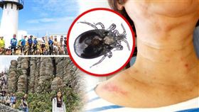 澎湖近千名民眾身上出現不明紅疹，而且奇癢無比，有醫師親身罹病且根據症狀判斷怪病兇手是「禽蟎」。（圖／CTWANT合成）