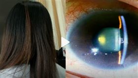 廣東,大陸,滑手機,女大生,瞳孔,白內障,近視
https://weibo.com/1618051664/KCp6vtZtw