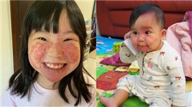 任家萱SelinaX陽光X全聯「愛從1開始」 助燒傷顏損孩子快樂成長（圖／陽光基金會提供）