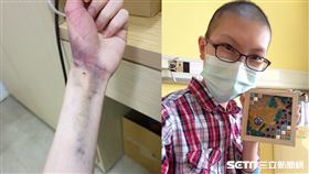 【生命鬥士專題】（其他稿件麻煩勿用喔，謝謝）