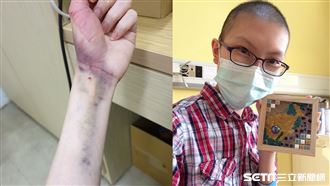 瘀青發癢確診血癌　鬥士重生後又復發