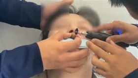 ▲ 女子吃田螺吸吮力道過大，結果拿不下來。（圖／翻攝自微博）