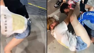 吃屎哥狠咬流血印！鄧佳華嚇打破傷風