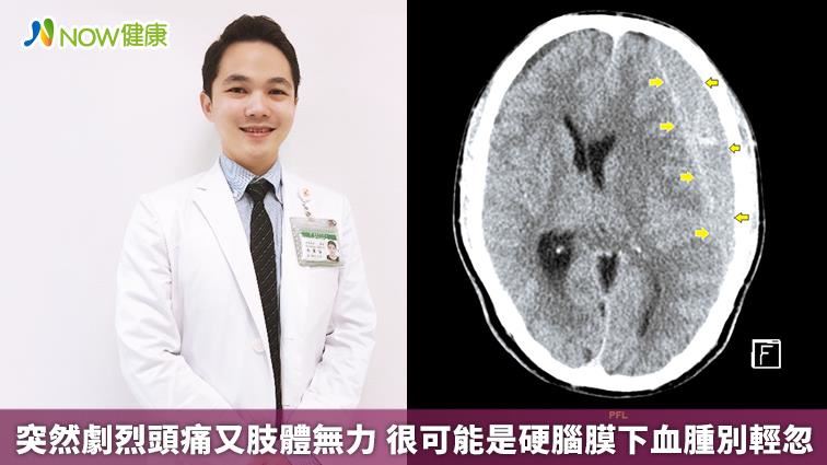 劇烈頭痛又肢體無力　可能是下血腫