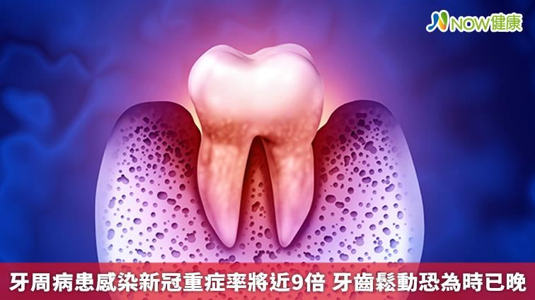 牙周病患若感染新冠　重症率將近9倍