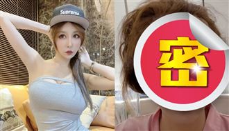 性感教主撒40萬　曝頭皮開洞整形貌