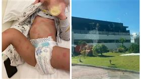 墾丁,屏東,民宿,毛毛蟲,紅疹