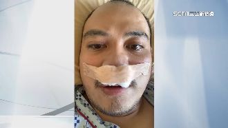 打疫苗後住院　申請3萬補助得等1年