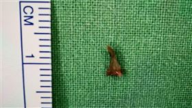 斷裂貓爪高速插入林先生小腿內（圖／安南醫院提供）