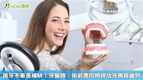名家專用／NOW健康／人工植牙雖已是相當純熟的治療方式，但植牙前須經由醫師規劃合適的植牙空間，以及評估是否需要矯正，才能確保口腔健康和治療一次到位。(勿用)