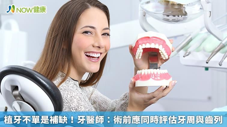 植牙不單是補缺 術前應評估這2個