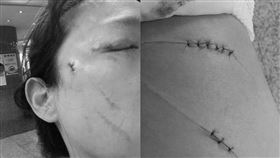 台北市,中山,挖眼,殺人未遂,傷害,美工刀