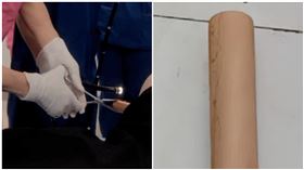 「超巨30公分」塞菊花！拿不出悲劇　30歲男曝超羞原因，圖／翻攝自新晚報